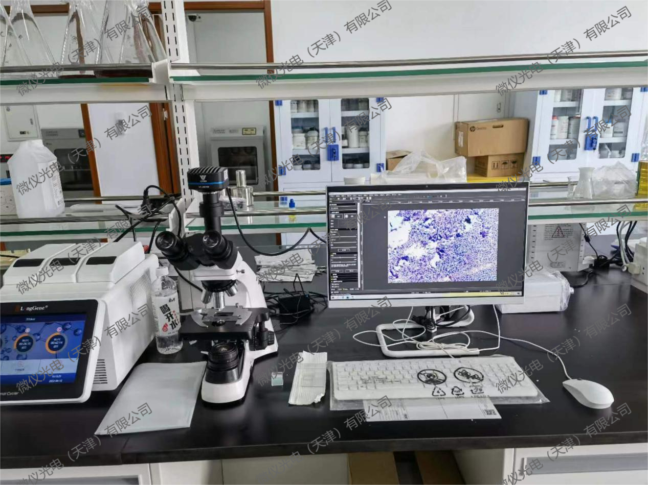 The School of Life Sciences at Nankai University procured the trinocular microscopy system V1800-2000M for E. coli observation The School of Life Sciences at Nankai University procured the trinocular microscopy system V1800-2000M for E. coli observation
