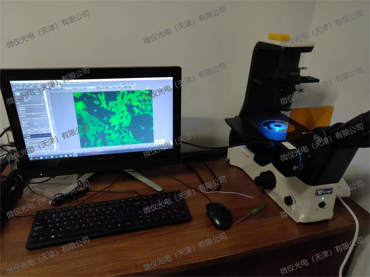 Nankai University People's Hospital purchased the WYS-41XDY for fluorescence observation of stained tissues Nankai University People's Hospital purchased the WYS-41XDY for fluorescence observation of stained tissues