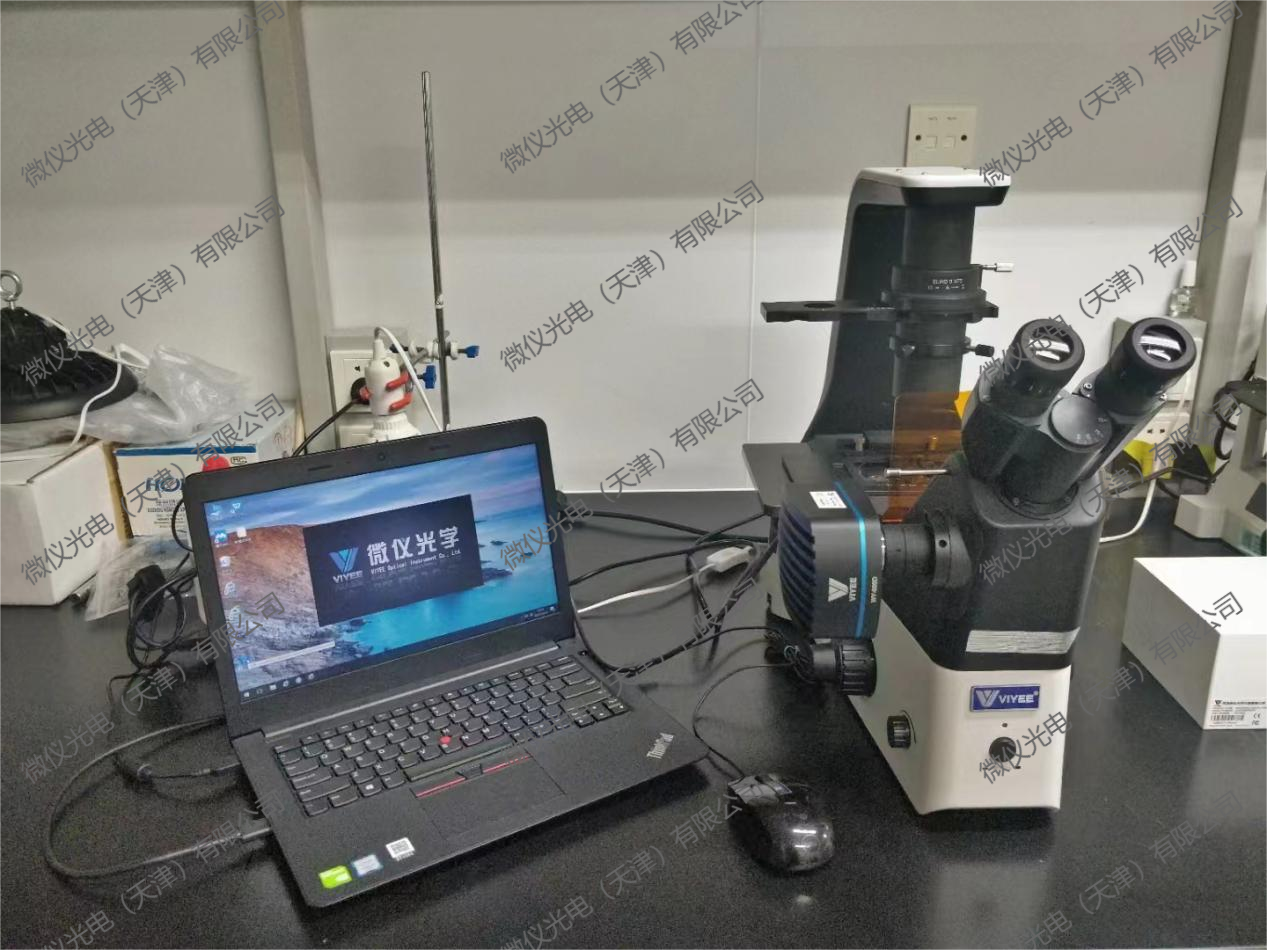 The National Key Laboratory of Nankai University procured the WYS-41XDY fluorescence microscope for fluorescence observation of cells stained with fluorescence The National Key Laboratory of Nankai University procured the WYS-41XDY fluorescence microscope for fluorescence observation of cells stained with fluorescence
